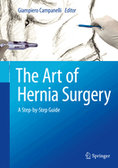 The Art of Hernia Surgery: A Step-By-Step Guide