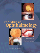 The Atlas of Ophthalmology