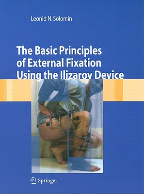 The Basic Principles of External Skeletal Fixation Using the Ilizarov Device - Solomin, Leonid N