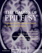 The Causes of Epilepsy: Common and Uncommon Causes in Adults and Children