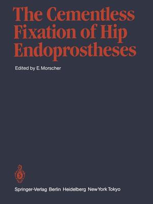 The Cementless Fixation of Hip Endoprostheses - Morscher, E (Editor)