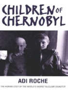 The Children of Chernobyl: Human Cost of the World's Worst Nuclear Disaster
