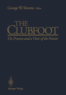 The Clubfoot: The Present and a View of the Future - Simons, George W (Editor), and Tachdjian, M O (Foreword by)