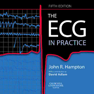 The ECG in Practice