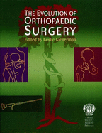 The Evolution of Orthopaedic Surgery