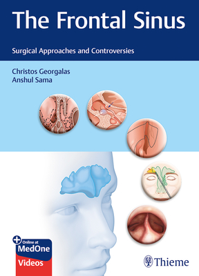 The Frontal Sinus: Surgical Approaches and Controversies - Georgalas, Christos (Editor), and Sama, Anshul (Editor)