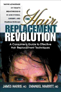 The Hair Replacement Revolution: A Consumer's Guide to Effective Hair Replacement Techniques