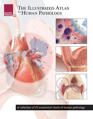 The Illustrated Atlas of Human Pathology: A Collection of 25 Anatomical Charts of Human Pathology - Scientific Publishing