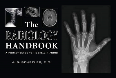 The Radiology Handbook: A Pocket Guide to Medical Imaging - Benseler, J S
