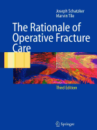 The Rationale of Operative Fracture Care