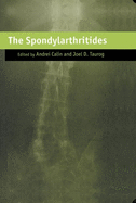 The Spondylarthritides