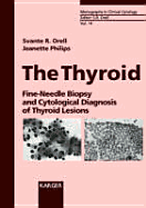 The Thyroid: Fine-Needle Biopsy and Cytological Diagnosis of Thyroid Lesions - Orell, S R