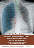 The Unofficial Guide to Radiology: 100 Practice Chest X Rays with Full Colour Annotations and Full X Ray Reports