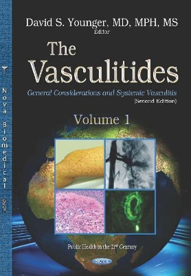 The Vasculitides: Volume 1 -- General Considerations and Systemic Vasculitis - Younger, David Steven (Editor)