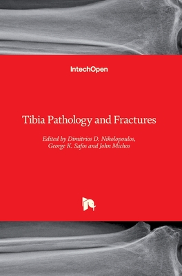 Tibia Pathology and Fractures - Nikolopoulos, Dimitrios D. (Editor), and Safos, George K. (Editor), and Michos, John (Editor)