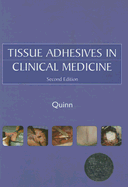 Tissue Adhesives in Clinical Medicine