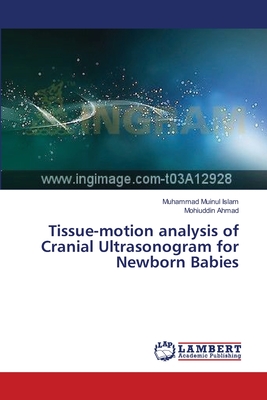 Tissue-motion analysis of Cranial Ultrasonogram for Newborn Babies - Islam, Muhammad Muinul, and Ahmad, Mohiuddin