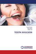 Tooth Avulsion