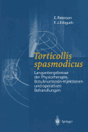 Torticollis Spasmodicus: Langzeitergebnisse Der Physiotherapie, Botulinumtoxin-Injektionen Und Operativen Behandlungen