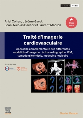 Trait d'Imagerie Cardiovasculaire: Approche Complmentaire Des Diffrentes Modalits d'Imagerie: chocardiographie, Irm, Tomodensitomtrie, Mdecine Nuclaire - Garot, Jrme, and Dacher, Jean-Nicolas, and Cohen, Ariel