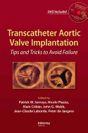 Transcatheter Aortic Valve Implantation: Tips and Tricks to Avoid Failure