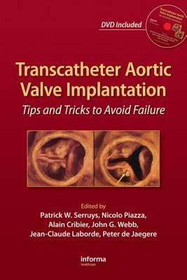 Transcatheter Aortic Valve Implantation: Tips and Tricks to Avoid Failure - Serruys, Patrick W, MD, PhD, Facc (Editor), and Piazza, Nicolo (Editor), and Webb, John G (Editor)