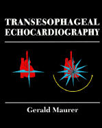 Transesophageal Echocardiography