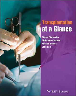 Transplantation at a Glance - Clatworthy, Menna, and Watson, Christopher, and Allison, Michael