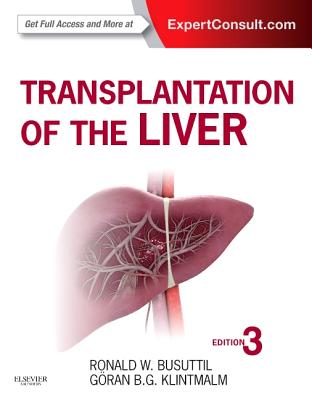 Transplantation of the Liver - Busuttil, Ronald W., and Klintmalm, Goran B.