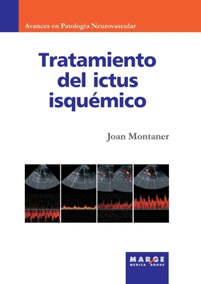 Tratamiento del ictus isqumico - Montaner, Joan