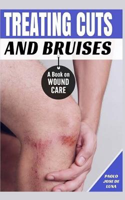 Treating Cuts and Bruises: A Book on Wound Care - Jose De Luna, Paolo