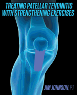 Treating Patellar Tendinitis with Strengthening Exercises