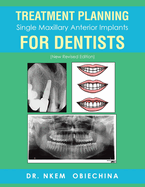 Treatment Planning Single Maxillary Anterior Implants for Dentists