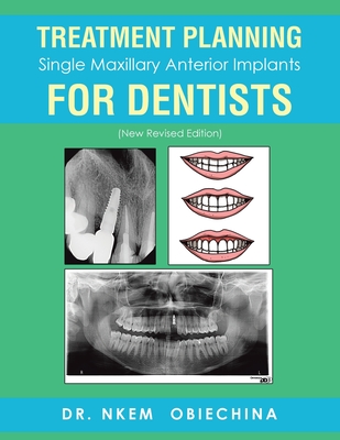 Treatment Planning Single Maxillary Anterior Implants for Dentists - Obiechina, Nkem, Dr.