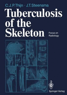 Tuberculosis of the Skeleton: Focus on Radiology