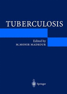 Tuberculosis