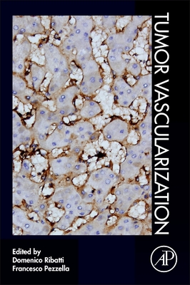 Tumor Vascularization - Ribatti, Domenico (Editor), and Pezzella, Francesco (Editor)