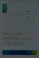 Tumors and Tumor-Like Lesions of the Lung: Volume 36 in the Major Problems in Pathology Series Volume 36