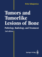 Tumors and Tumorlike Lesions of Bone: Pathology, Radiology, and Treatment