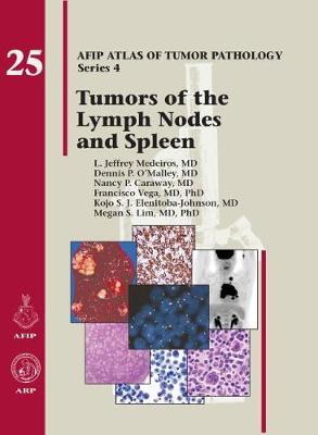 Tumors of the Lymph Nodes and Spleen - Medeiros, L. Jeffrey, and O'Malley, Dennis P., and Caraway, Nancy P.