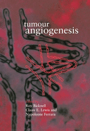Tumour Angiogenesis