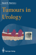 Tumours in Urology