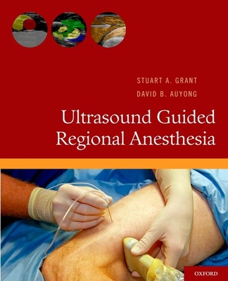 Ultrasound Guided Regional Anesthesia - Grant, Stuart A, and Auyong, David B