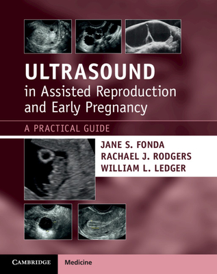 Ultrasound in Assisted Reproduction and Early Pregnancy: A Practical Guide - Fonda, Jane S, and Rodgers, Rachael J, and Ledger, William L