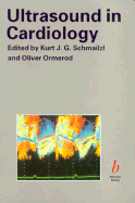 Ultrasound in cardiology