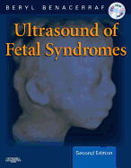Ultrasound of Fetal Syndromes: Text with DVD