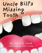 Uncle Bill's Missing Tooth