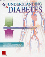 Understanding Diabetes Flip Chart