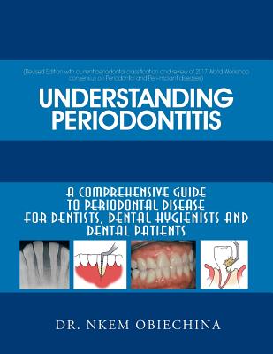 Understanding Periodontitis: A Comprehensive Guide to Periodontal Disease for Dentists, Dental Hygienists and Dental Patients - Obiechina, Nkem, Dr.