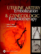 Uterine Artery Embolization and Gynecologic Embolotherapy